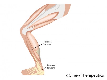 Lower Leg Pain and Injuries Information - Sinew Therapeutics